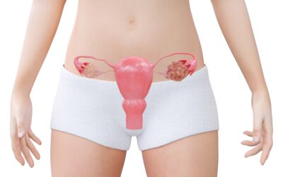 Κύστεις Ωοθηκών