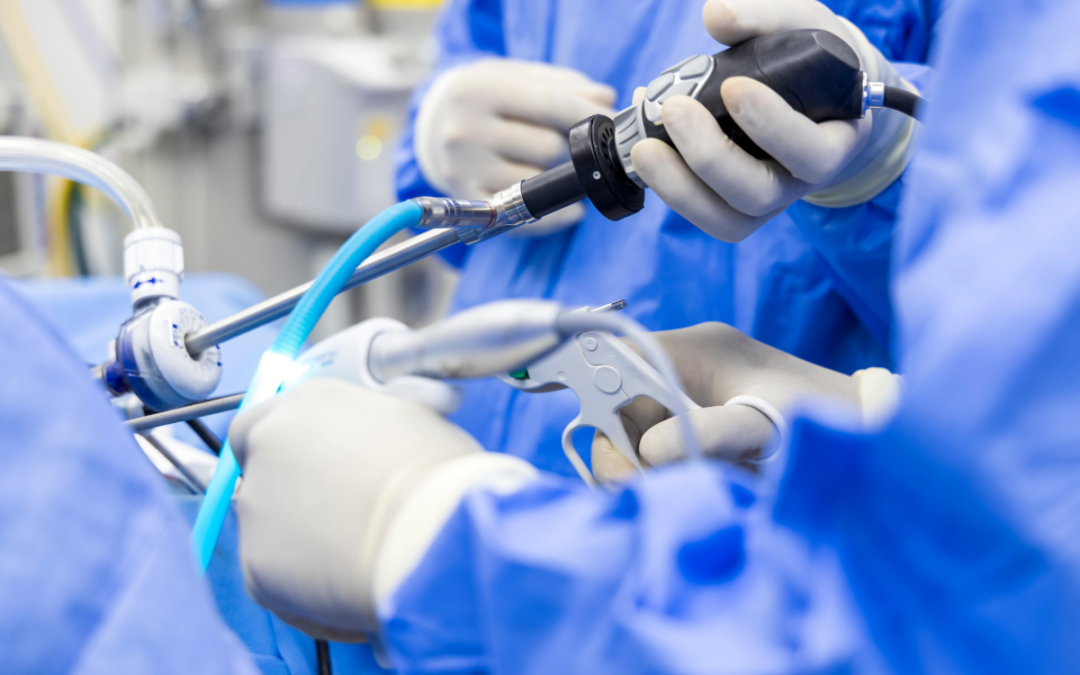 Λαπαροσκόπηση