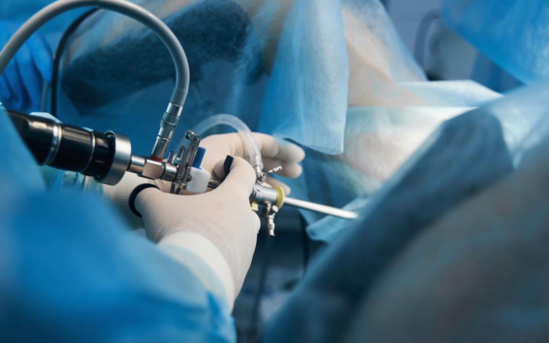 Υστεροσκόπηση